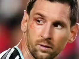 No easy wins in FIFA World Cup: Lionel Scaloni says ‘suffering part of our DNA’ as Argentina survive Switzerland scare | Football News